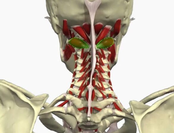 Vertebral arter sendromu